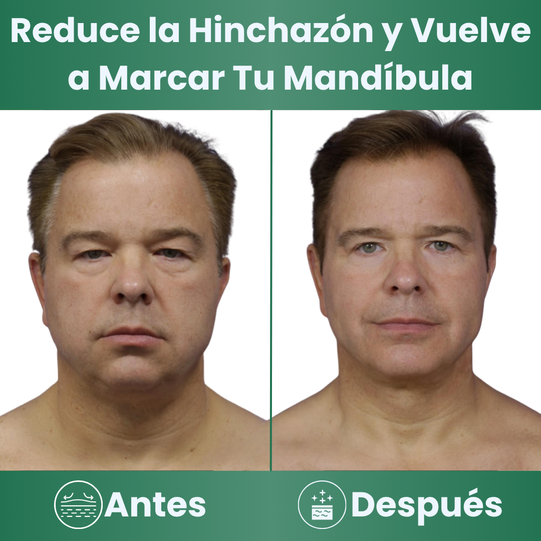Gotas de Apoyo Renal / Caelia™