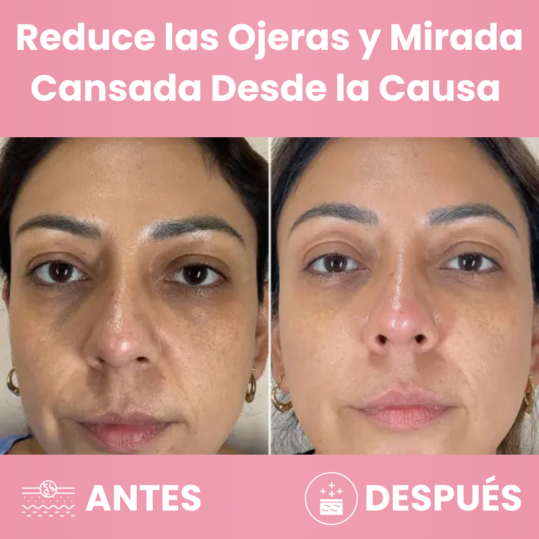 Caelia™ Bálsamo Para Ojos