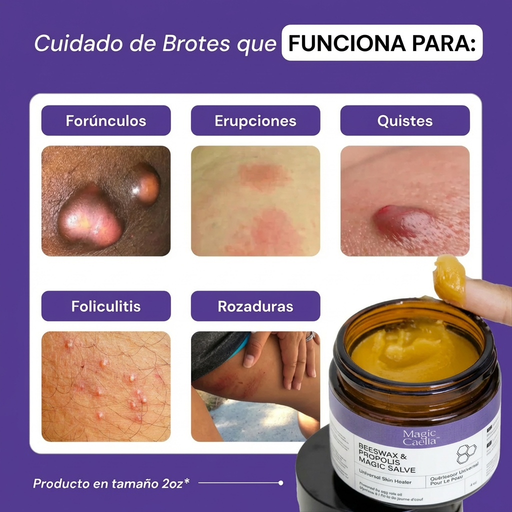 Caelia™ Crema Intensiva Para Abscesos